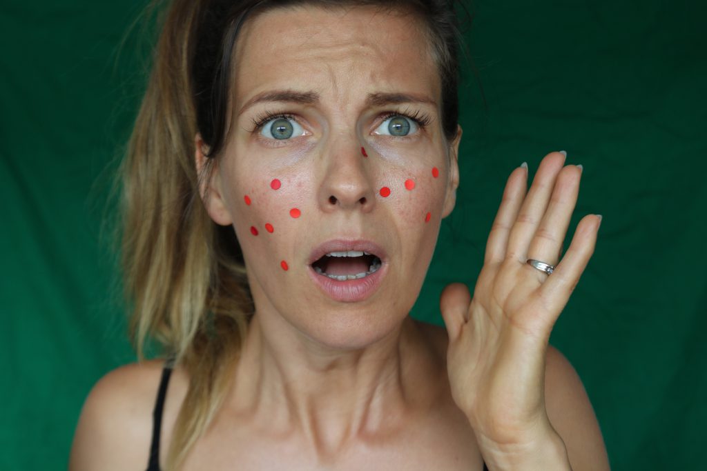 rosacée traitement blog suisse thereseandthekids beauté